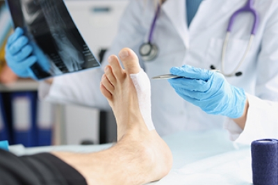 Common Types of Foot Surgery