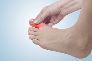 Differences Between Bunions and Gout