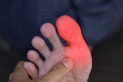 Causes of Burning Toe Pain