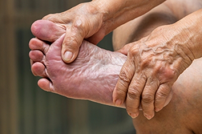 Conditions Causing Red Feet in Elderly People